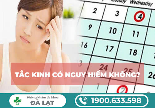 Hình ảnh minh họa